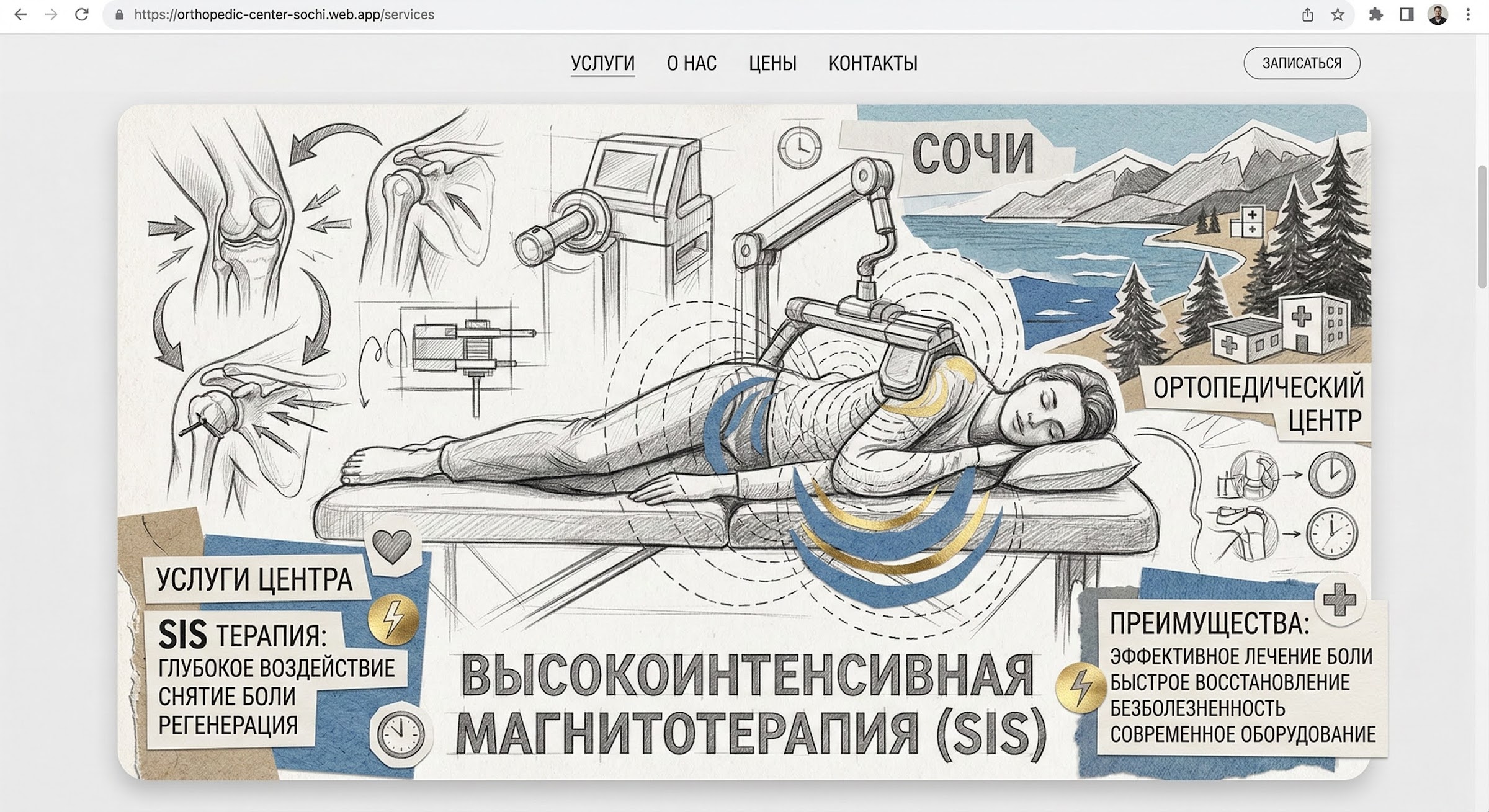 SIS Illustration 2